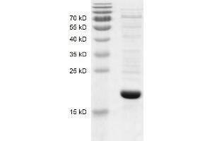 Recombinant BRD1 (556-688) protein gel.
