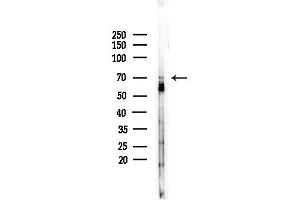 Western blot analysis of lysates from COLO205 cells(heat-shock,45 min treatment), using PICALM Antibody at 1/1000 dilution.