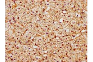 IHC image of ABIN7148764 diluted at 1:300 and staining in paraffin-embedded human adrenal gland tissue performed on a Leica BondTM system. (CAND1 Antikörper  (AA 1150-1230))