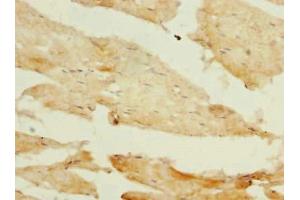 Immunohistochemistry of paraffin-embedded human skeletal muscle tissue using ABIN7163163 at dilution of 1:100 (PIK3R1 Antikörper  (Regulatory Subunit A))