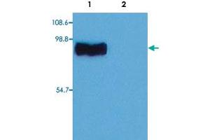 Western Blotting analysis (non-reducing conditions) of whole cell lysate of RBL (rat basophilic leukemia cell line). (STIM1 Antikörper  (C-Term))