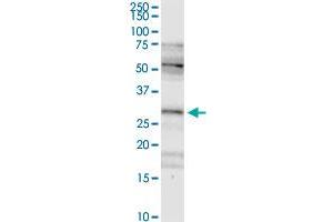 FHL2 MaxPab rabbit polyclonal antibody. (FHL2 Antikörper  (AA 1-279))