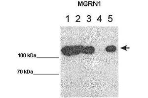 WB Suggested Anti-MGRN1 Antibody    Positive Control:  Lane 1: 10ug MGRN1-GFP transfected HEK293T Lane 2: 10ug mut1MGRN1-GFP transfected HEK293T Lane 3: 10ug mut1MGRN2-GFP transfected HEK293T Lane 4: 10ug GFP transfected HEK293T Lane 5: 10ug IP for GFP using lysate from lane 1   Primary Antibody Dilution :   1:1000   Secondary Antibody :  Goat anti rabbit-HRP   Secondry Antibody Dilution :   1:50,000  Submitted by:  Teresa Gunn, McLaughin Research Institute MGRN1 is supported by BioGPS gene expression data to be expressed in HEK293T (Mahogunin RING Finger Protein 1 Antikörper  (Middle Region))