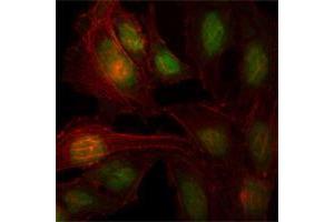 Immunofluorescence analysis of Hela cells using ZBTB7B mouse mAb (green). (ZBTB7B Antikörper)