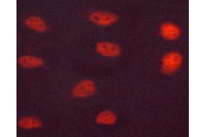 Immunofluorescence (fixed cells) (IF/ICC) image for anti-Hepatocyte Nuclear Factor 4, alpha (HNF4A) (pSer313) antibody (ABIN6256265)