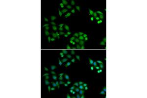 Immunofluorescence analysis of HeLa cell using NSFL1C antibody. (NSFL1C Antikörper)