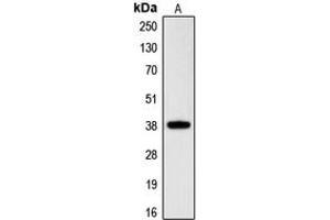 Western blot analysis of RNF197 expression in HeLa (A) whole cell lysates.