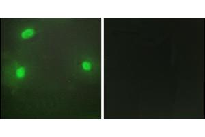 Immunofluorescence analysis of HeLa cells, using FEN1 antibody. (FEN1 Antikörper)