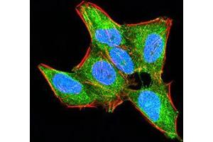 Immunocytochemistry (ICC) image for anti-Homeobox A9 (HOXA9) (AA 1-272) antibody (ABIN5868688) (HOXA9 Antikörper  (AA 1-272))