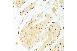 Immunohistochemistry of paraffin-embedded human esophagus using DKC1 Antibody (ABIN5970956) at dilution of 1/100 (40x lens). (DKC1 Antikörper)