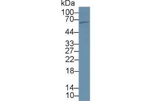 Detection of PCSK9 in Rat Liver lysate using Polyclonal Antibody to Proprotein Convertase Subtilisin/Kexin Type 9 (PCSK9) (PCSK9 Antikörper  (AA 164-428))