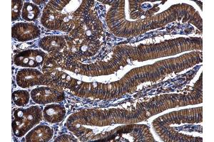 IHC-P Image ARL14 antibody [N1C3] detects ARL14 protein at cytoplasm and membrane in mouse duodenum by immunohistochemical analysis. (ARL14 Antikörper  (full length))