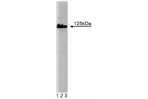 Western blot analysis of DNA Polymerase delta on Jurkat lysate. (POLD1 Antikörper  (AA 60-261))