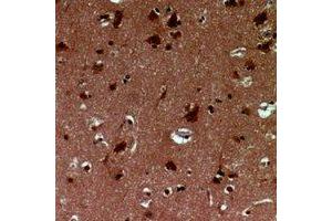 Immunohistochemical analysis of EID1 staining in human brain formalin fixed paraffin embedded tissue section. (EID1 Antikörper)