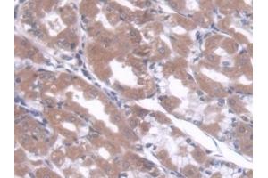Immunohistochemistry (IHC) image for anti-Core-Binding Factor, beta Subunit (CBFB) (AA 1-182) antibody (ABIN7444154)