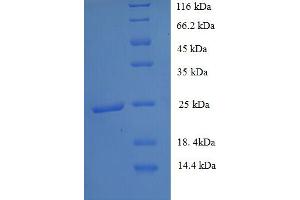 SDS-PAGE (SDS) image for Solute Carrier Family 26, Member 3 (SLC26A3) (AA 814-1011), (partial) protein (His tag) (ABIN5713112) (SLC26A3 Protein (AA 814-1011, partial) (His tag))