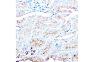 Immunohistochemistry of paraffin-embedded human liver using ZIP14 Rabbit pAb (ABIN6133191, ABIN6147993, ABIN6147994 and ABIN6214658) at dilution of 1:50 (40x lens). (SLC39A14 Antikörper  (AA 240-340))