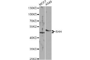Western blot analysis of extracts of various cell lines, using SHH antibody (ABIN5975790) at 1/1000 dilution. (Sonic Hedgehog Antikörper)