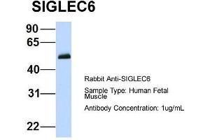 Host:  Rabbit  Target Name:  SIGLEC6  Sample Type:  Human Fetal Muscle  Antibody Dilution:  1.