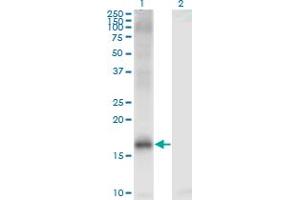Western Blot analysis of JARID1A expression in transfected 293T cell line by JARID1A monoclonal antibody (M03), clone 1H2.