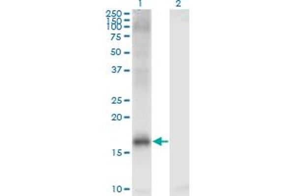 KDM5A antibody  (AA 191-290)