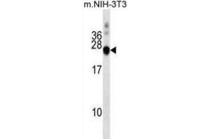 Western Blotting (WB) image for anti-DnaJ (Hsp40) Homolog, Subfamily C, Member 5 (DNAJC5) antibody (ABIN2999623) (DNAJC5 Antikörper)