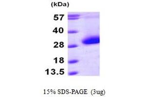 SDS-PAGE (SDS) image for Cyclin-Dependent Kinase Inhibitor 3 (CDKN3) (AA 1-212) protein (His tag) (ABIN667848)