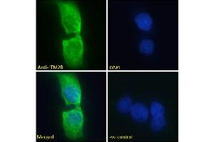 ABIN570955 Immunofluorescence analysis of paraformaldehyde fixed A431 cells, permeabilized with 0.