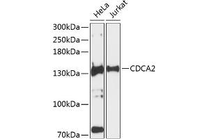 Western blot analysis of extracts of various cell lines, using CDC antibody (ABIN6131118, ABIN6138269, ABIN6138270 and ABIN6224963) at 1:3000 dilution. (CDCA2 Antikörper  (AA 724-1023))