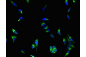 Immunofluorescent analysis of Hela cells using ABIN7145558 at dilution of 1:100 and Alexa Fluor 488-congugated AffiniPure Goat Anti-Rabbit IgG(H+L)