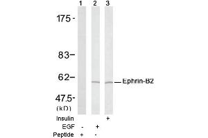 Image no. 1 for anti-Ephrin B2 (EFNB2) (Tyr316) antibody (ABIN197416) (Ephrin B2 Antikörper  (Tyr316))