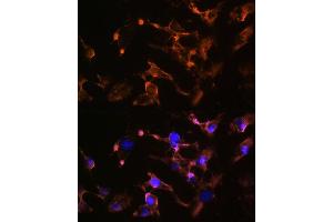 Immunofluorescence analysis of U-251 MG cells using AMPH Rabbit pAb (ABIN6127430, ABIN6136846, ABIN6136847 and ABIN6221037) at dilution of 1:100 (40x lens). (Amphiphysin Antikörper  (AA 340-620))