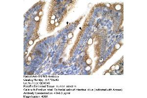 Human Intestine (TRPM5 Antikörper  (N-Term))