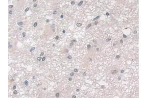 Immunohistochemistry (IHC) image for anti-Glutathione Peroxidase 3 (Plasma) (GPX3) (AA 21-72) antibody (ABIN7435298)