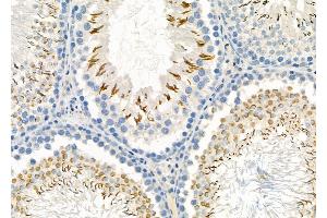 ABIN6265308 and ABIN6273168 at 1/100 staining Rat testis tissue by IHC-P. (Stanniocalcin 2 Antikörper  (C-Term))