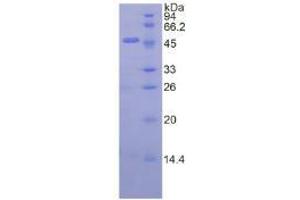 SDS-PAGE analysis of Pig Interferon beta Protein. (IFNB1 Protein)