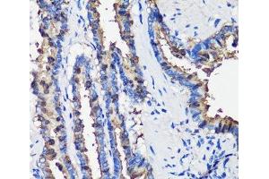 Immunohistochemistry of paraffin-embedded Rat lung using SCGB1A1 Polyclonal Antibody at dilution of 1:100 (40x lens). (SCGB1A1 Antikörper)