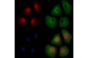 CBX4 Antibody staining A549 cells by IF/ICC. (CBX4 Antikörper  (Internal Region))