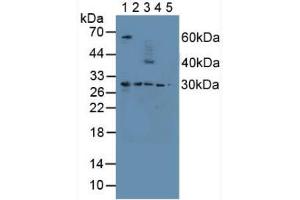Figure. (Proteasome 26S Subunit, Non ATPase 9 (AA 2-223) Antikörper)