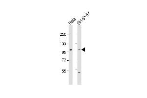 All lanes : Anti-ADCY5 Antibody (Center) at 1:1000-1:2000 dilution Lane 1: Hela whole cell lysate Lane 2: SH-SY5Y whole cell lysate Lysates/proteins at 20 μg per lane.