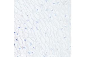 Immunohistochemistry of paraffin-embedded Human normal uterus (negative control sample) using MUC1 Rabbit mAb (ABIN7268687) at dilution of 1:100 (40x lens). (MUC1 Antikörper)