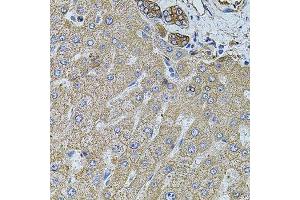 Immunohistochemistry (Paraffin-embedded Sections) (IHC (p)) image for anti-Filamin B, beta (FLNB) (AA 1686-1785) antibody (ABIN1679857)