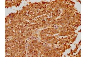 Immunohistochemistry (IHC) image for anti-Proteasome (Prosome, Macropain) Subunit, beta Type, 8 (Large Multifunctional Peptidase 7) (PSMB8) (AA 176-276) antibody (ABIN7164990)