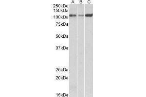 ABIN1686784 (0. (ATP2A2 Antikörper  (Internal Region))
