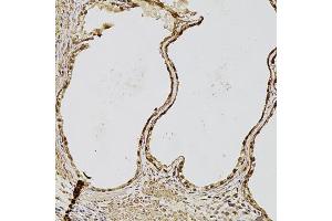 Immunohistochemistry of paraffin-embedded human prostate using FGF2 antibody (ABIN1872685) at dilution of 1:100 (20x lens). (FGF2 Antikörper)
