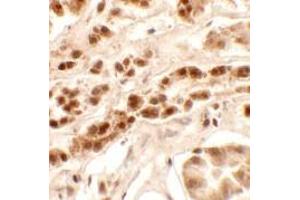 Immunohistochemistry (IHC) image for anti-Patched Domain Containing 2 (PTCHD2) (Middle Region) antibody (ABIN1031050) (PTCHD2 Antikörper  (Middle Region))