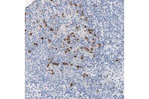 Immunohistochemical staining of human lymph node with GZMB polyclonal antibody  shows strong cytoplasmic positivity in a subset of lymphoid cells outside reaction center at 1:50-1:200 dilution. (GZMB Antikörper)