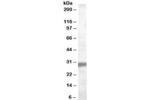 Western blot testing of human muscle lysate with EGLN3 antibody at 0. (EGLN3 Antikörper)