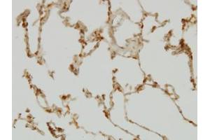 Image no. 4 for anti-SH2 Domain Containing 4A (SH2D4A) (AA 239-338) antibody (ABIN599292) (SH2D4A Antikörper  (AA 239-338))