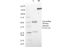 SDS-PAGE Analysis Purified GAD1 (GAD67) Mouse Monoclonal Antibody (GAD1/2563). (GAD Antikörper  (AA 72-135))